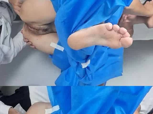 Fake gynecologist got a spear when he saw the patient's
