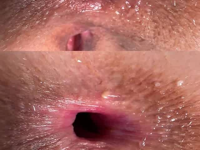 A Girl with a Wide Butthole Fucks Insta Reel of Girl with a Big Mouth
