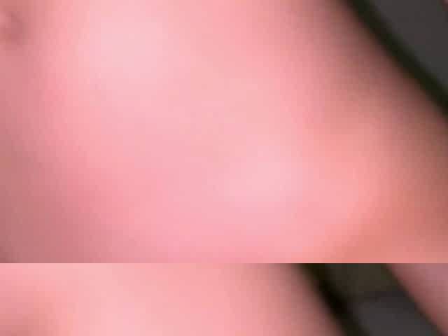 Ridding BF Dick