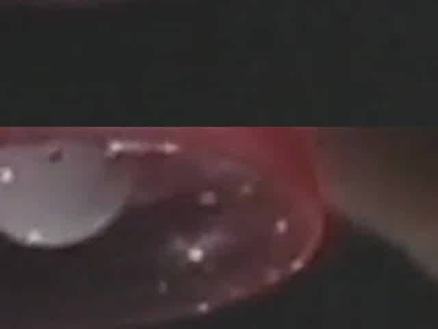 Anal Aliens