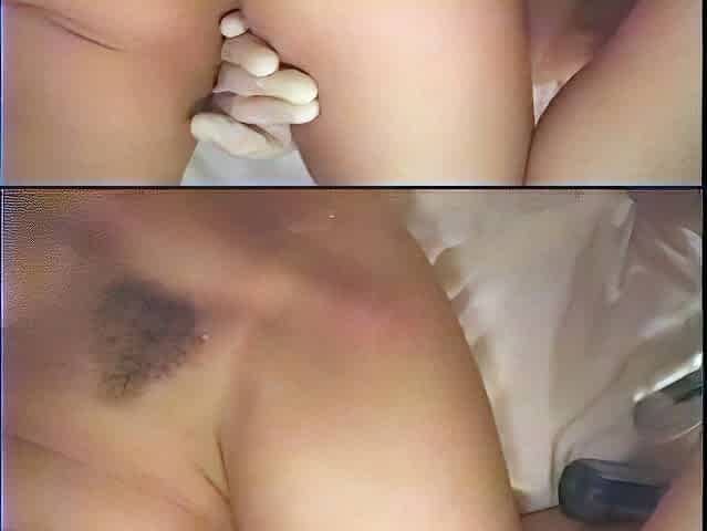 Anal and Fisting For Beautiful Brunette