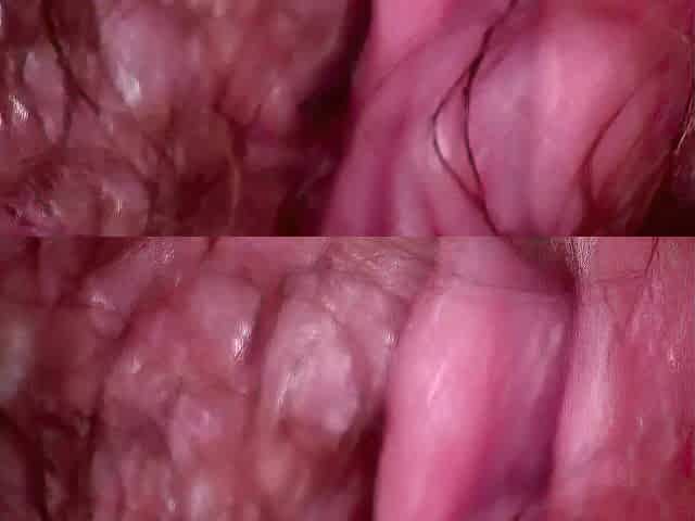 INSIDE THE URETHRA peehole big beautiful woman Aged mother I'd like to fuck endoscope