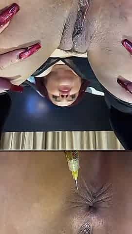 La Potra Aleja in an anal rejuvenation and a bit of ass in the same episode