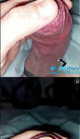 cum play with phimosis constricted foreskin
