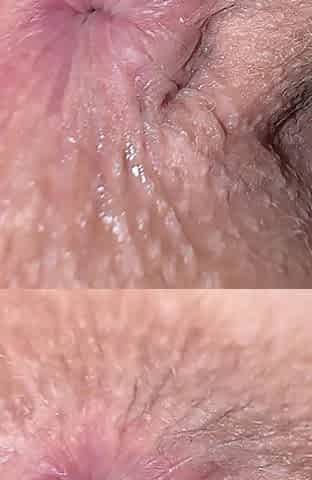 First Time Sex Always Seems Special. Pale Skin Girl Close Ups