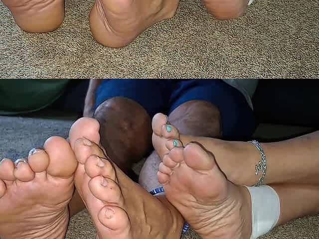 Showing off our soft aged soles and her bandaged leg