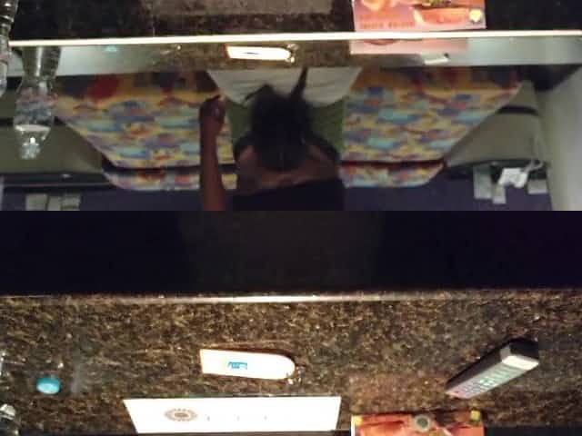 fat sucking in hotel