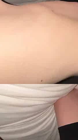 Strange Trends 18 Years Old Girl Got a Tattoo of Dark Anal Pigmentation
