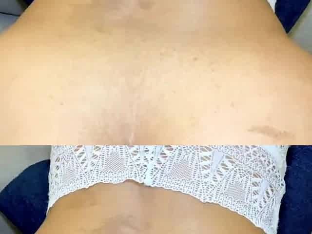 First Anal for Asian MILF Can't Take All of His Big Dick