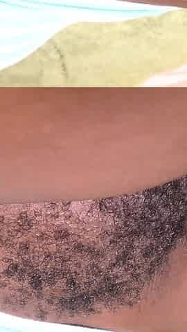 Black Hairy Pussy Fucked and Filled by a Big White Cock and a Sticky Load of Semen