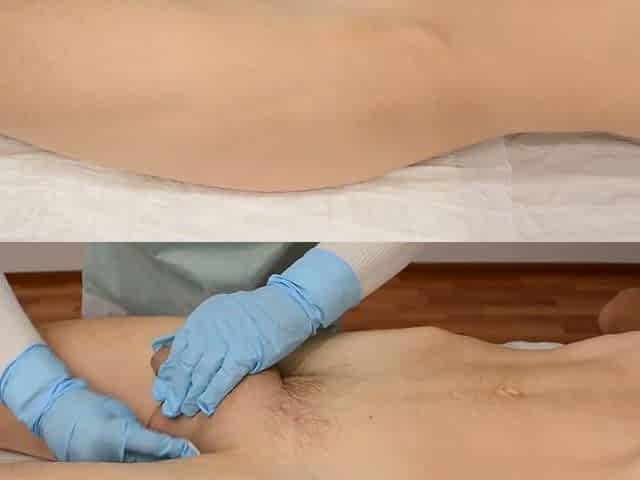 Waxing of a Huge Hanging Penis