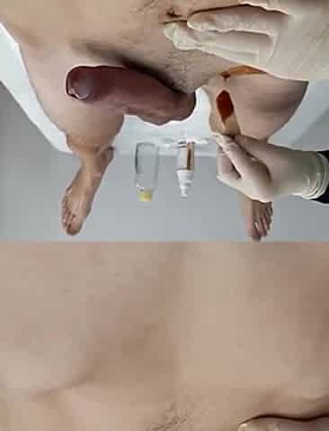 Depilation of a Pulsating, Swollen Penis. the Cosmetologist Is Confused.