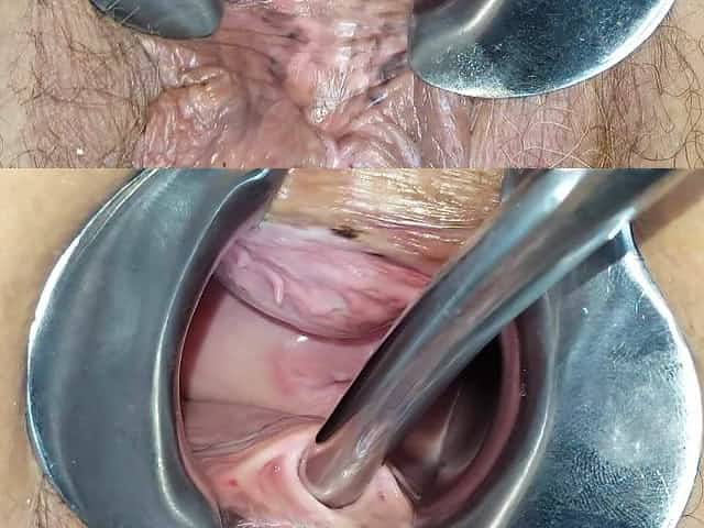 Peehole and speculum play