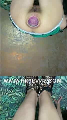 Hotkinkyjo belly bulge, long dildo, fisting & anal prolapse