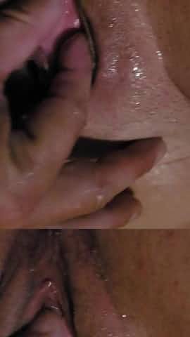 Peehole closeup with prolapse