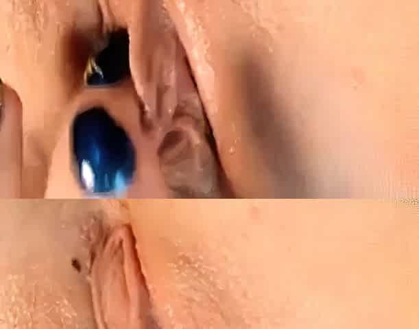 Super Lips: Amateur Medical Webcam Close-Up