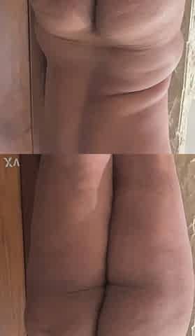 Hot butt