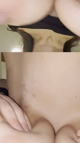 Cracked Nipples Check