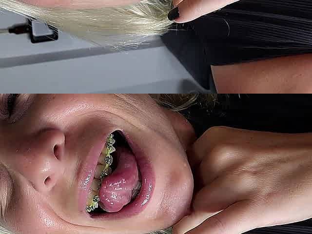 Licking and Sucking My Metal Braces Anal Plug POV