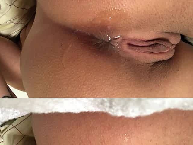 Anal Orgasm