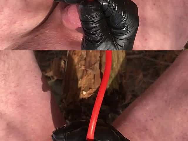 Outdoor neon catheter insertion