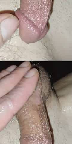 Anal Play