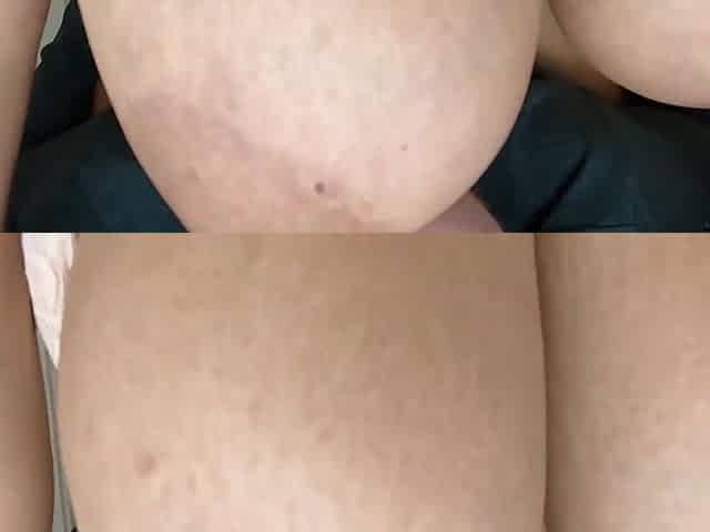 Massive Tits Oriental Teen Gets Giant Milk Breasts Sucked
