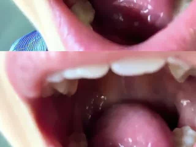 Cute teen anne solo anal masturbation