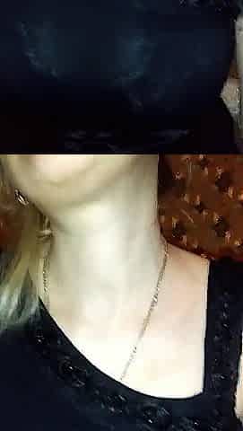 Annyke