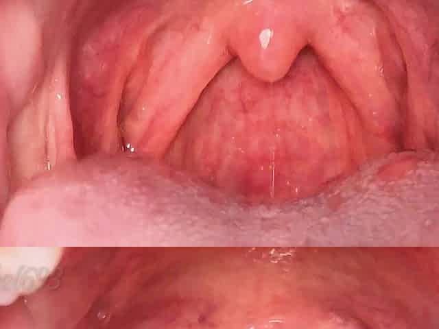 Mouth Fetish Uvula Close I Gag on a Hard BBC