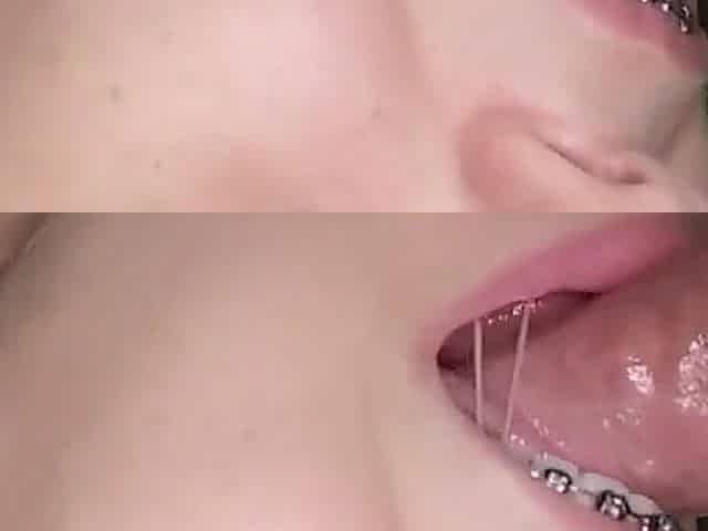 Sloppy blowjob from braces