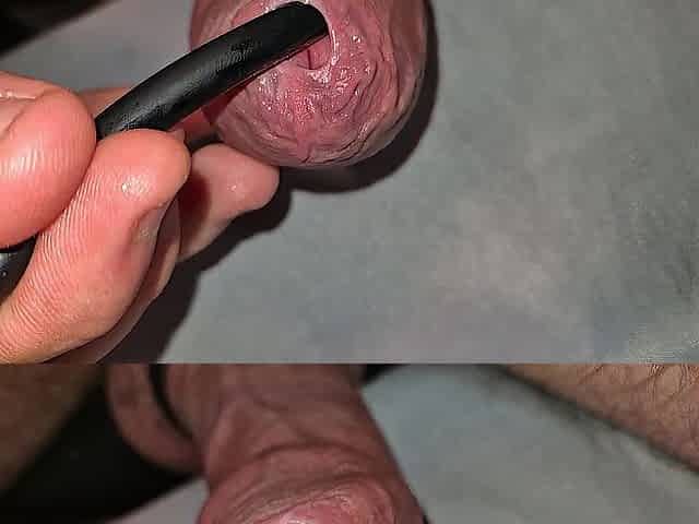 phimosis taut foreskin soaked play