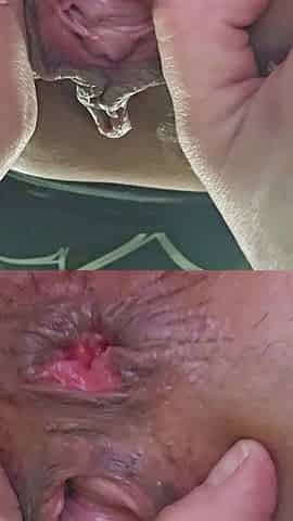 You Are a Toilet for Me, I Want to Fart in Your Dirty Mouth.