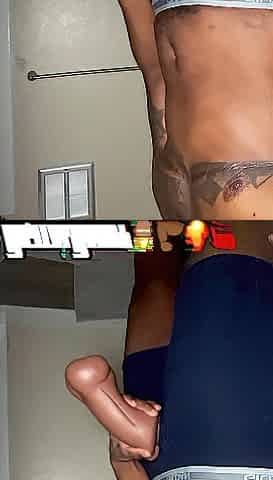 Ftm Phalloplasty