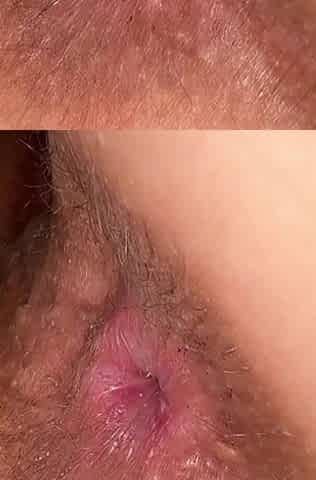 She Has a Hairy Pussy and I Have a Small Penis. She Shaved It, and I Enlarged It.