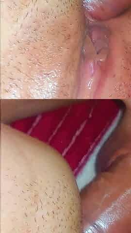Short anal