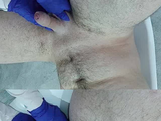 The nurse thoroughly massaged the patient's testicles and weenie to collect semen for analysis.