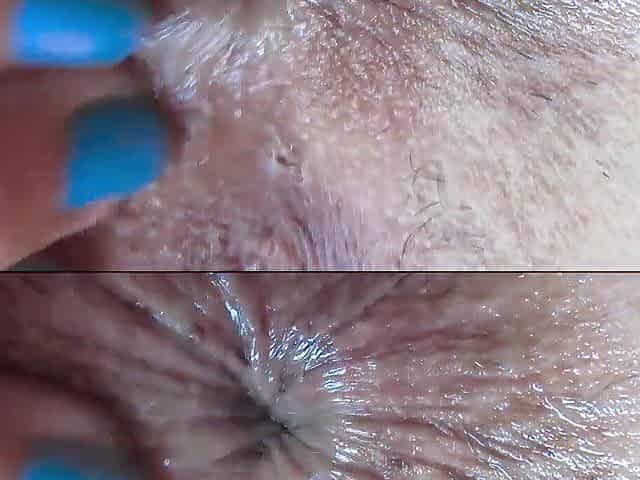 close up anal
