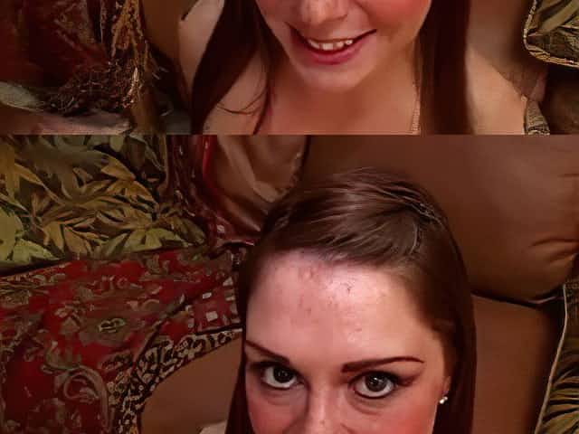 Facial 4 Freckles