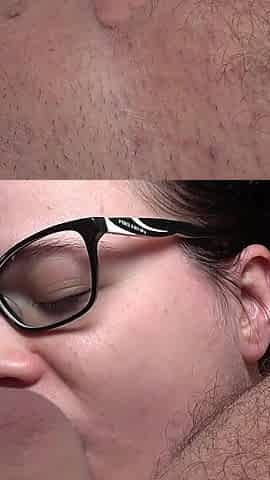 Facial