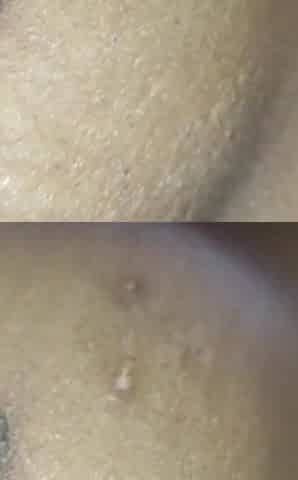 Deshi Style Ass Hole Pussy Nude Back