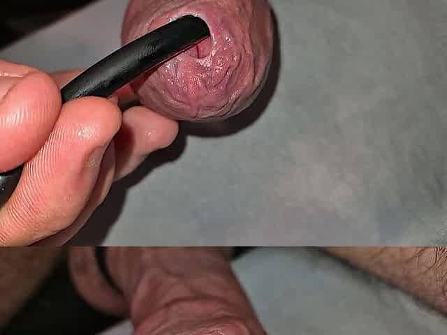 phimosis taut foreskin moist play