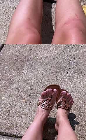 Kinky Erotic Milf In Amazing Foot Fetish Play