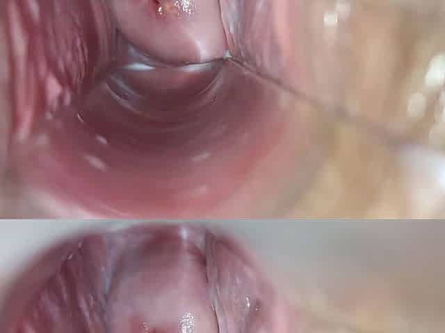 inside vagina