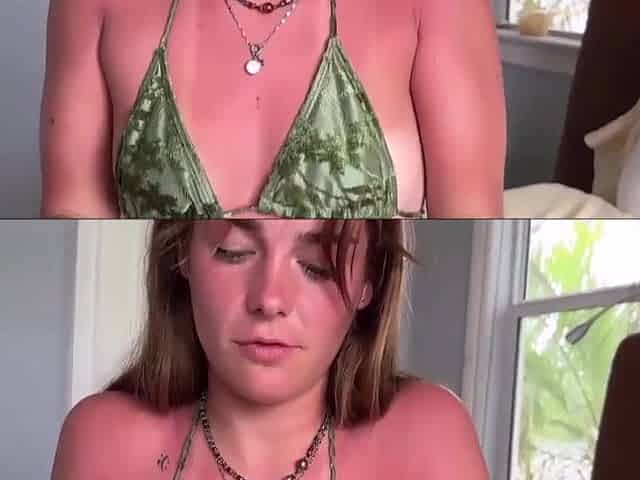 Putting Aloe Vera On Little StepSis - stepsister massage