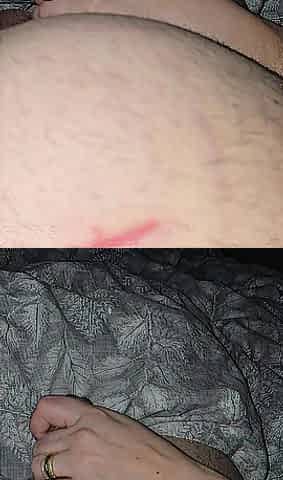 Step son after surgery get a tugjob from step mamma precious hand
