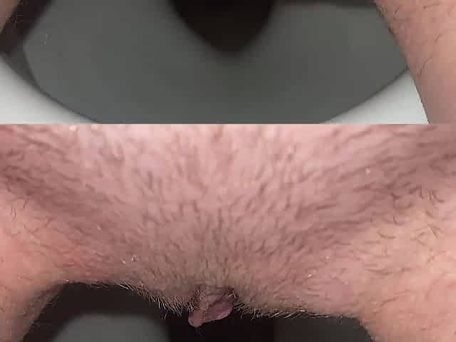 vagina urine