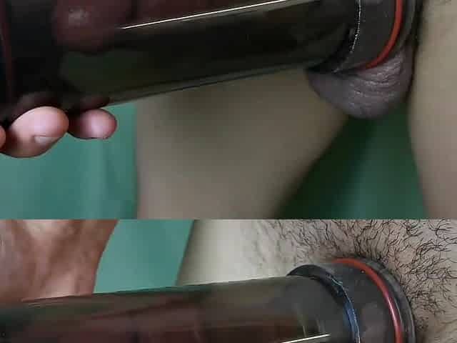 vacuum pump increases penis