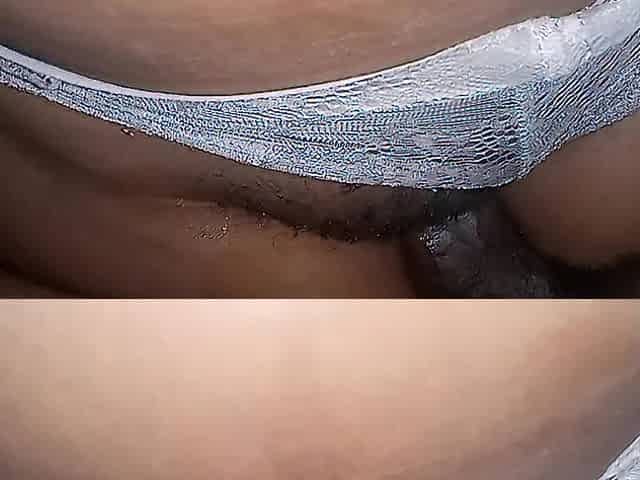 PANTS TO THE SIDE PRONE BONE AND FAILED ANAL