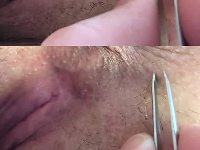 ANAL DEPILATION & VAGINA SHAVING.